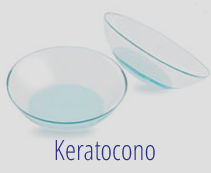 Lentes de contacto Keratocono